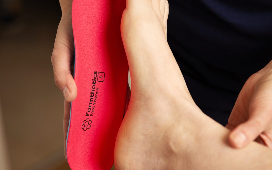 Functional Shoe Insoles (Formthotics)