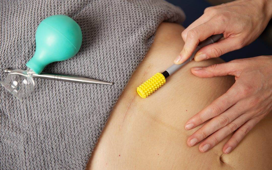 Scar Treatment & Healing